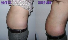 Depelle: ¿Sabes cómo te ayudamos a esculpir tu cuerpo?